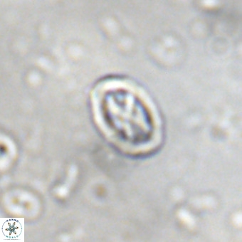 Davidhakania partingtonii VR 452