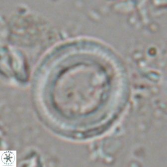 Denisea magna 20850