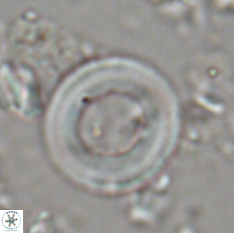 Denisea magna 20851