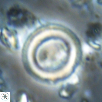 Denisea magna 20852