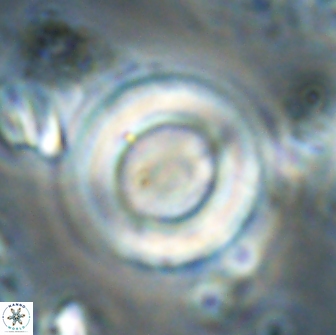Denisea magna 20853