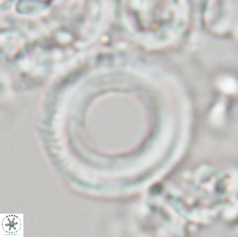 Denisea magna 21339