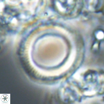 Denisea magna 21340