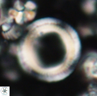 Denisea magna 21539