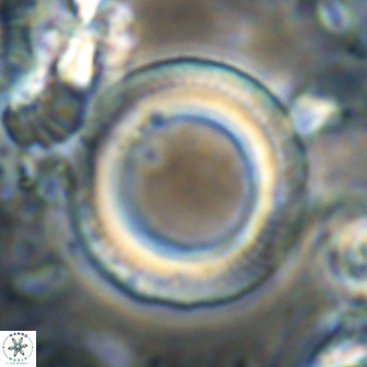 Denisea magna 21544