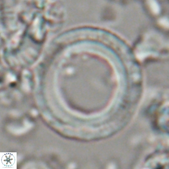 Denisea magna 21540