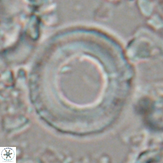 Denisea magna 21541