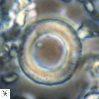 Denisea magna 21543