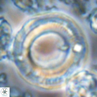 Denisea magna 22045