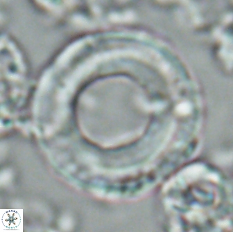Denisea magna 22043