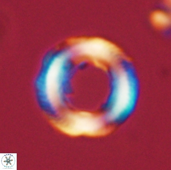 Denisea magna 52560