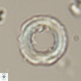 Denisea magna 52561