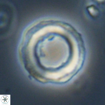 Denisea magna 52562