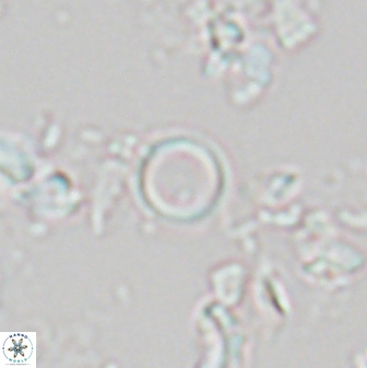 Denisea orbis 22449