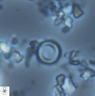 Denisea orbis 22451