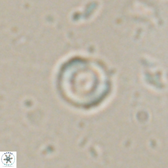 Denisea orbis 53847