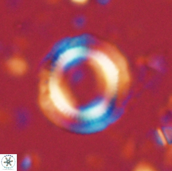 Denisea atalikii 3544