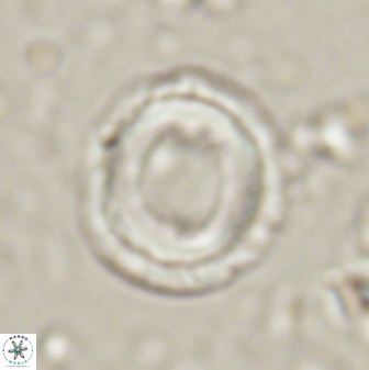 Denisea atalikii 3548