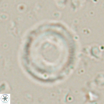 Denisea atalikii 3549