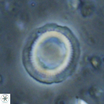 Denisea atalikii 3554