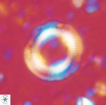 Denisea atalikii 3558