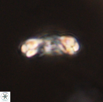 Denisea atalikii 45731