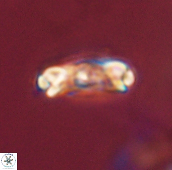 Denisea atalikii 45733