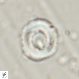 Denisea atalikii 55150