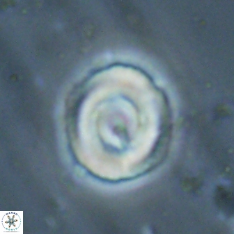 Denisea atalikii 55151