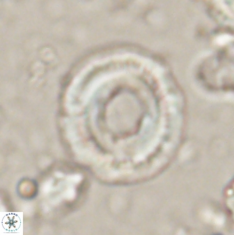 Denisea atalikii 53447