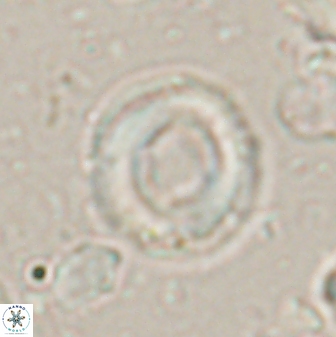 Denisea atalikii 53448