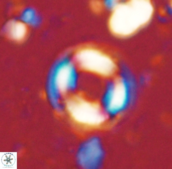 Denisea atalikii 53442