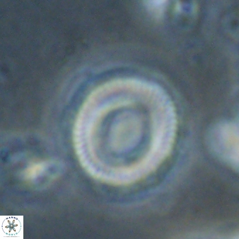 Denisea atalikii 53454