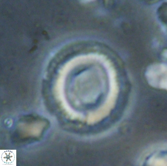 Denisea atalikii 53455