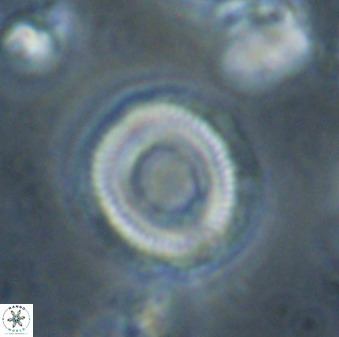 Denisea atalikii 53459