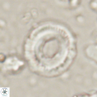 Denisea atalikii 53451