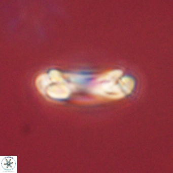Denisea aliquanta 53122
