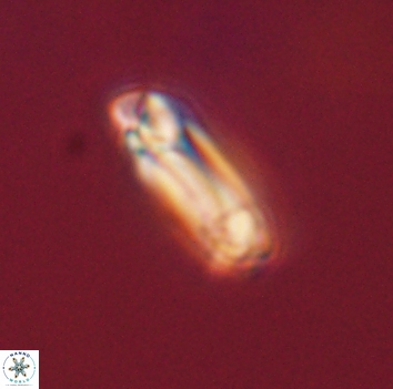Denisea aliquanta 53280