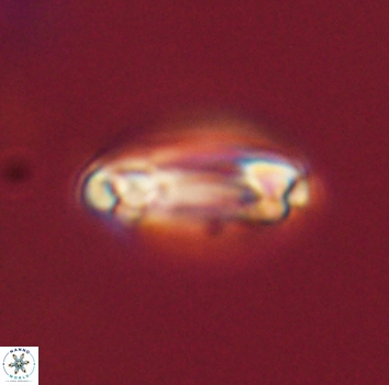 Denisea aliquanta 53283