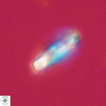 Denisea aliquanta 20786