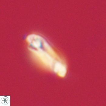 Denisea aliquanta 20789