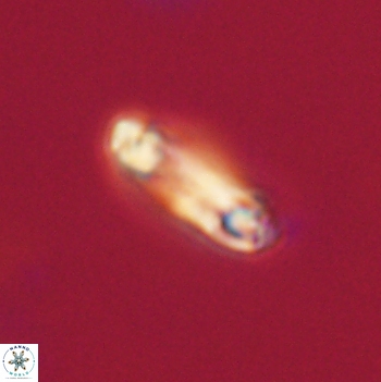 Denisea aliquanta 20793