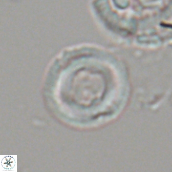 Denisea aliquanta 20856