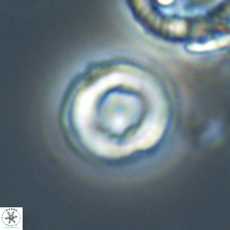 Denisea aliquanta 20857