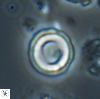 Denisea aliquanta 20832
