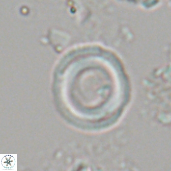 Denisea aliquanta 20833