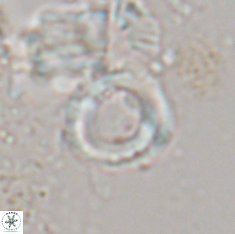 Denisea aliquanta 21022