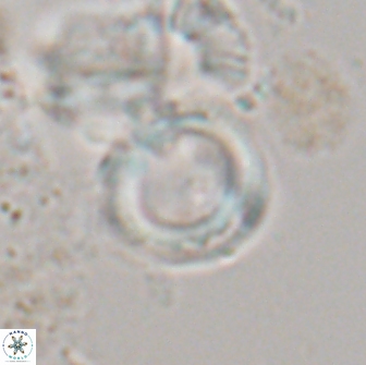 Denisea aliquanta 21023