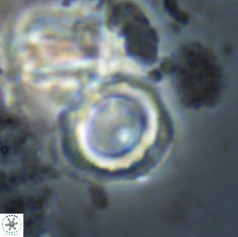 Denisea aliquanta 21024