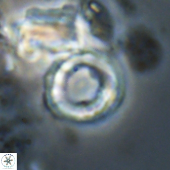 Denisea aliquanta 21025